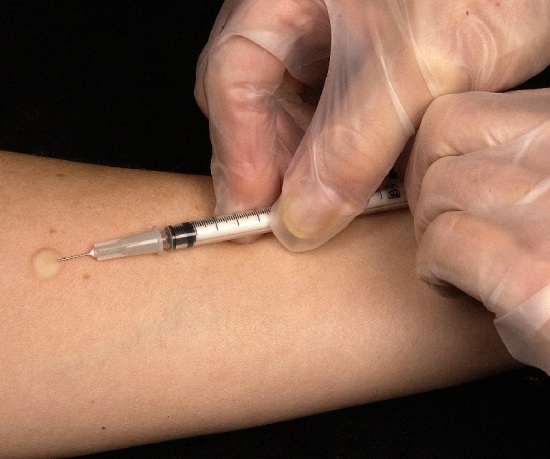 Inmunoterapia para vacunarse contra las alergias